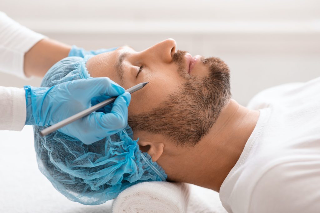 ניתוח שקיות מתחת לעיניים