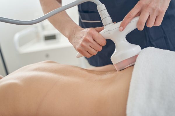 המסת שומן בלייזר