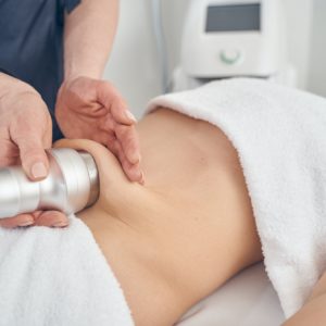 הצרת היקפים