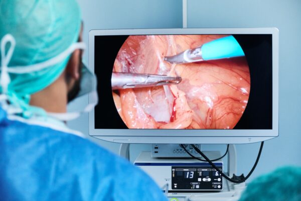 doctor in a laparoscopic surgery look at the image on a screen