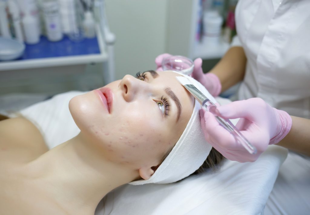 טיפול בפצעי אקנה