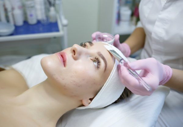 טיפול בפצעי אקנה