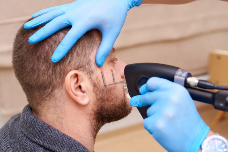 טיפול באקנה בלייזר