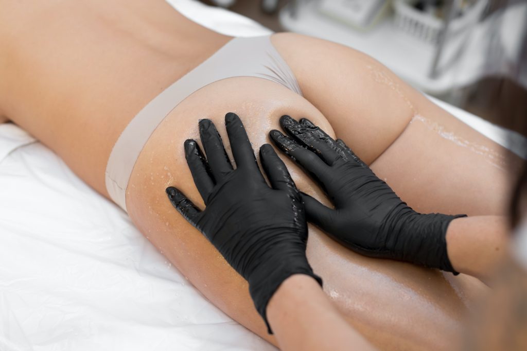 טיפול באקנה בישבן