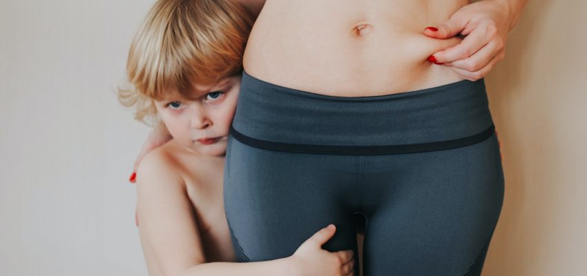 צלוליט בהריון