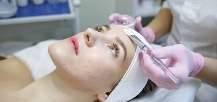 טיפול בפצעי אקנה