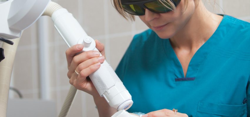 לייזר להסרת שיער בפנים