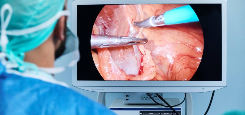 doctor in a laparoscopic surgery look at the image on a screen