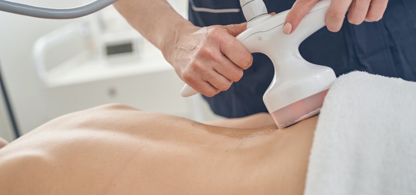 המסת שומן בלייזר