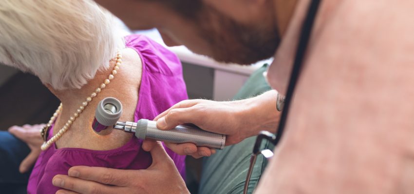 טיפול להסרת כתמי גיל