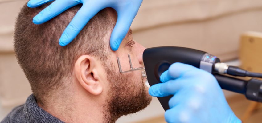 טיפול באקנה בלייזר