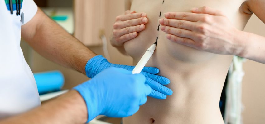 ניתוח חזה לנשים