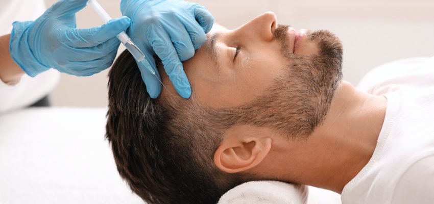 השתלת שיער בטורקיה לפני ואחרי