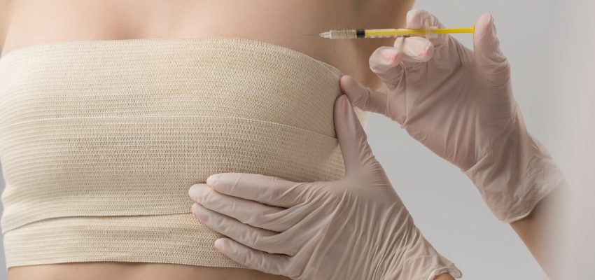 הרמת חזה לפני ואחרי