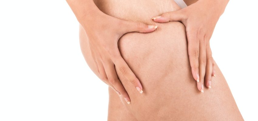 איך להוריד צלוליטיס