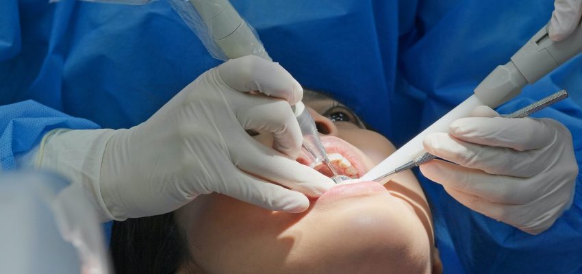 טיפול שורש בשיניים